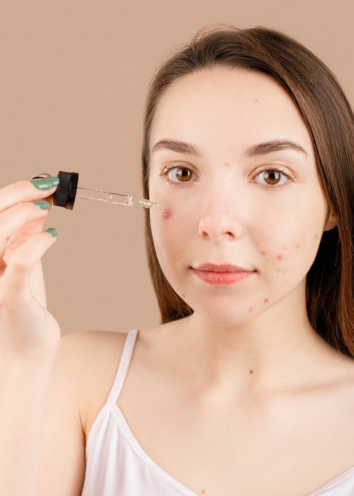 Best Serum For Acne Scars 5 Brands that Work!